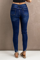 Distressed Button Fly Skinny Jeans
